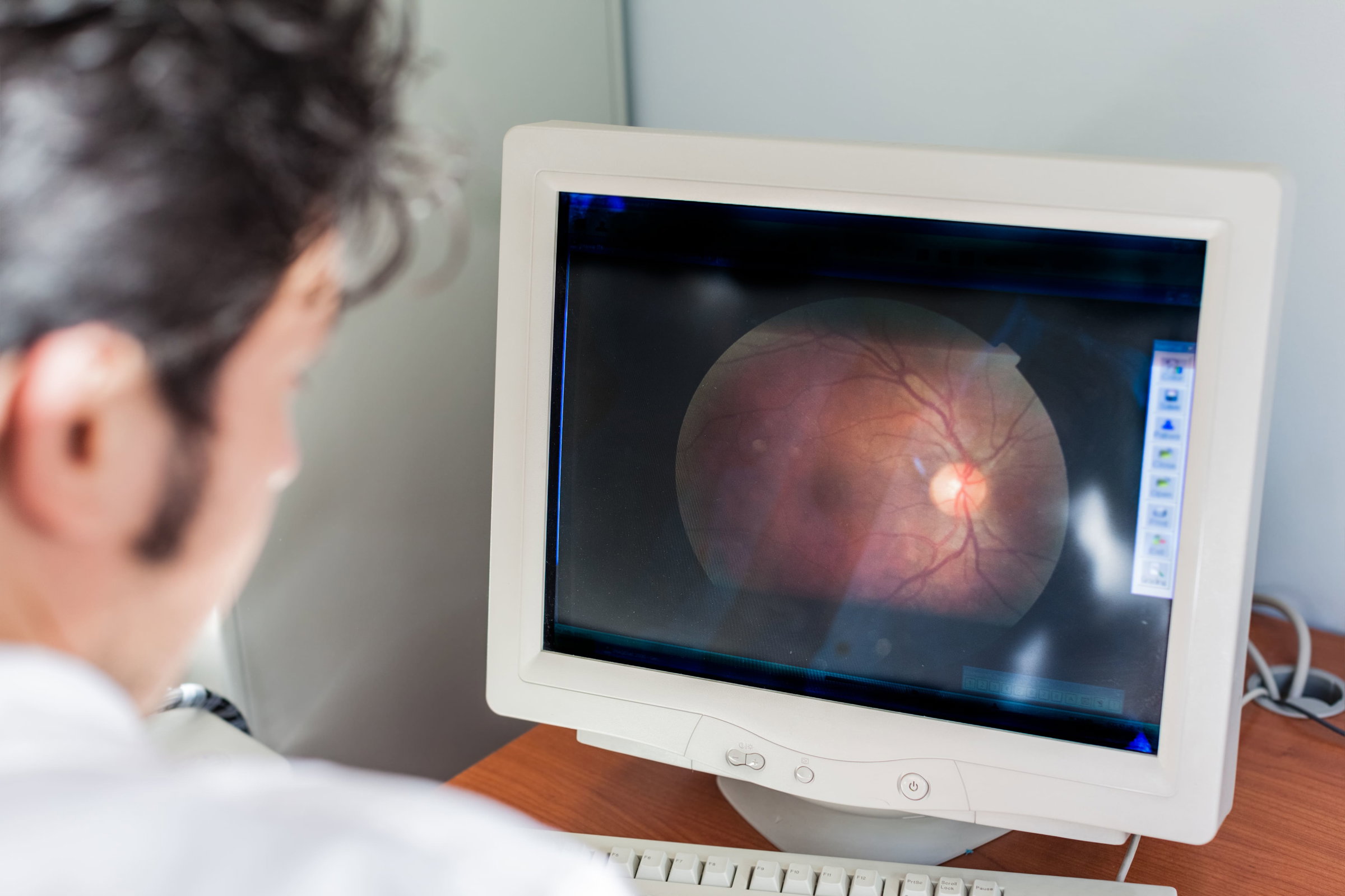 Optos imaging featured by Jewel City Optometry